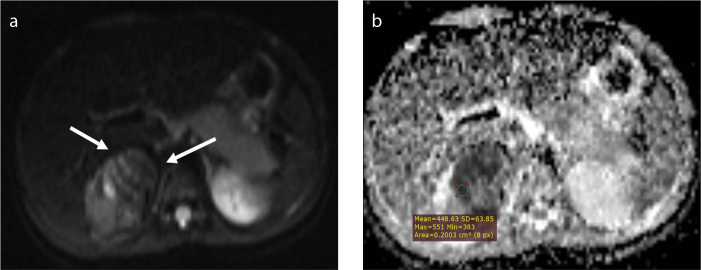 Figure 2. a, b