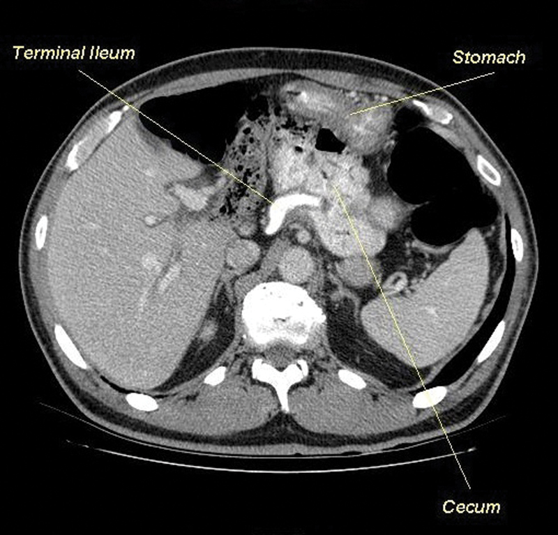 Fig. 2