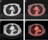 Fig. 5