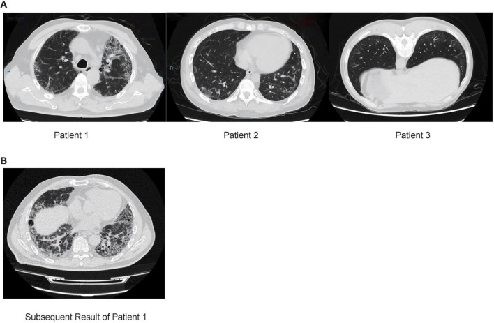 FIGURE 1