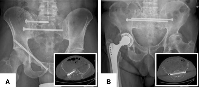 Fig. 1A–B