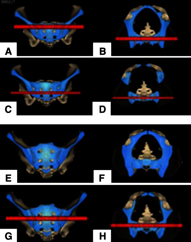 Fig. 3A–H