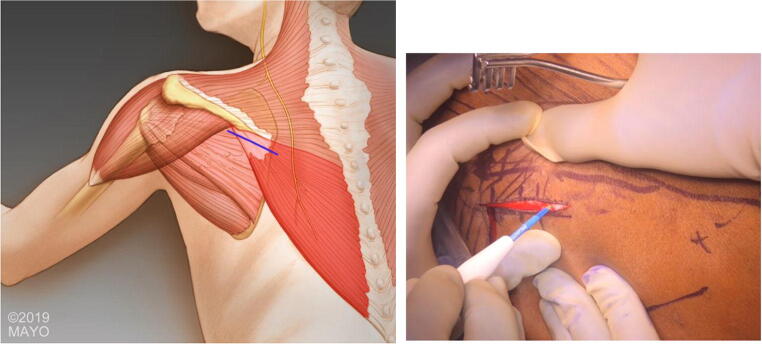 Fig. 4