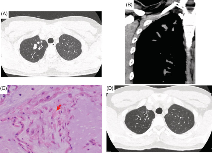 FIGURE 1