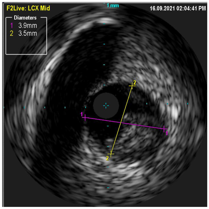 Figure 5