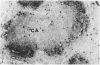 110