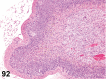 Figure 92.