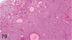 Figure 79.
