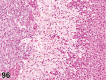 Figure 96.
