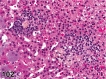 Figure 102.
