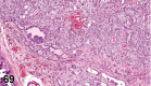 Figure 69.