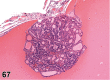 Figure 67.