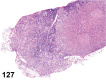 Figure 127.