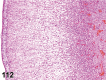 Figure 112.