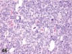 Figure 46.