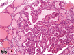 Figure 66.