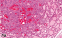 Figure 76.