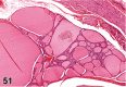 Figure 51.