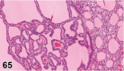 Figure 65.