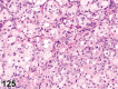 Figure 125.