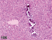 Figure 106.