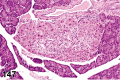 Figure 147.