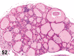 Figure 52.