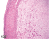 Figure 137.