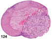 Figure 124.