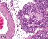 Figure 157.