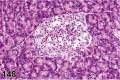 Figure 148.