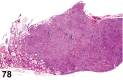 Figure 78.