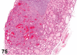 Figure 75.