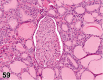 Figure 59.