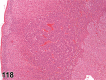 Figure 118.