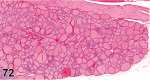 Figure 72.