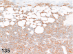 Figure 135.