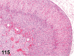 Figure 115.