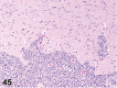 Figure 45.