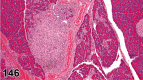 Figure 146.