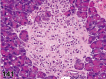 Figure 141.