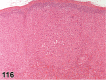Figure 116.