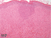 Figure 117.