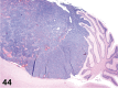 Figure 44.