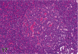 Figure 17.