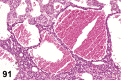 Figure 91.