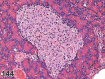 Figure 144.
