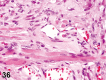 Figure 36.