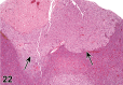 Figure 22.