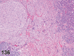 Figure 136.